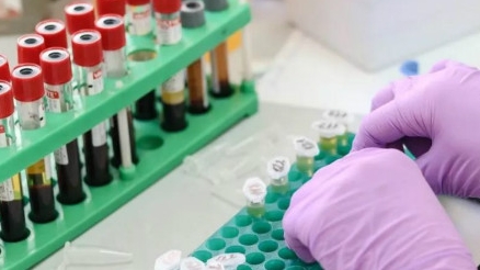 为防“死灰复燃”　希腊政府紧急应对: 加大病毒检测力度