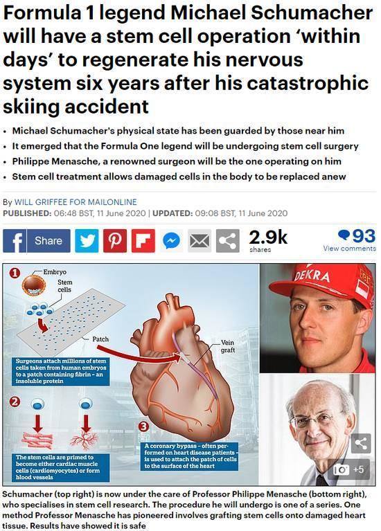 英国《泰晤士报》报道了舒马赫即将接受这项手术的细节.jpg