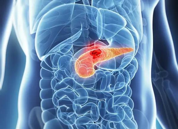 胰腺位于腹部什么位置图片